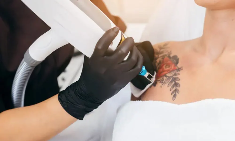 Laser Tattoo Removal by Instinct Holistic Medical Spa in BOZEMAN, MT