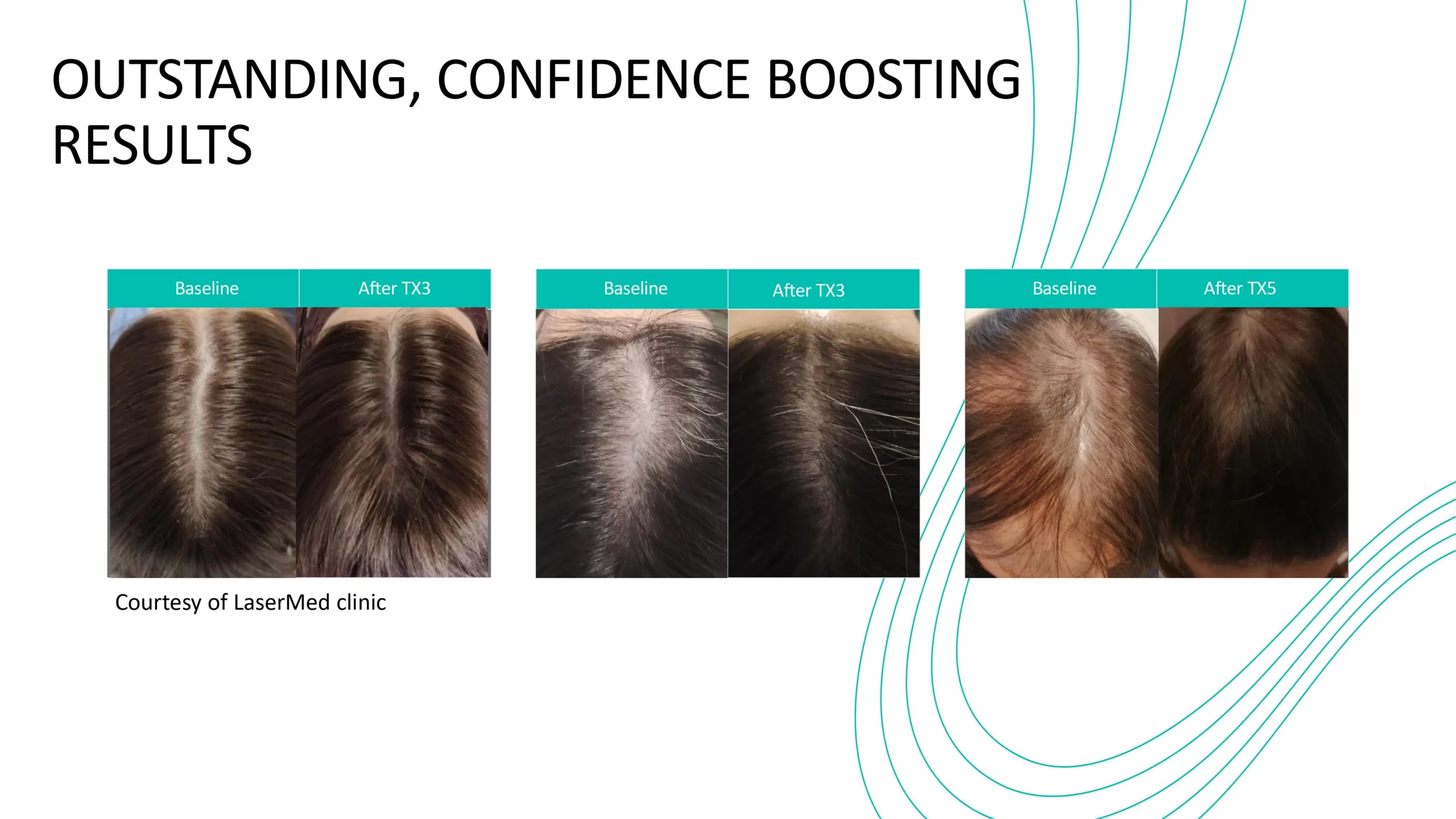 Folix-Confidence-Boosting-Results in Bozeman, MT