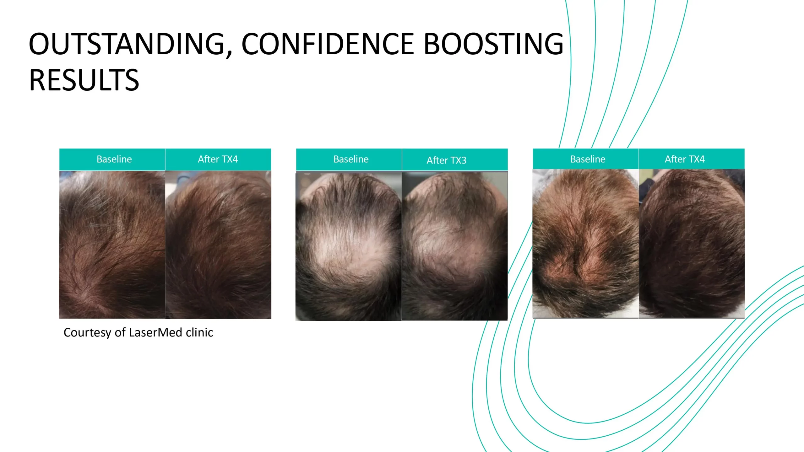 Folix-Confidence-Boosting-Results in Bozeman, MT