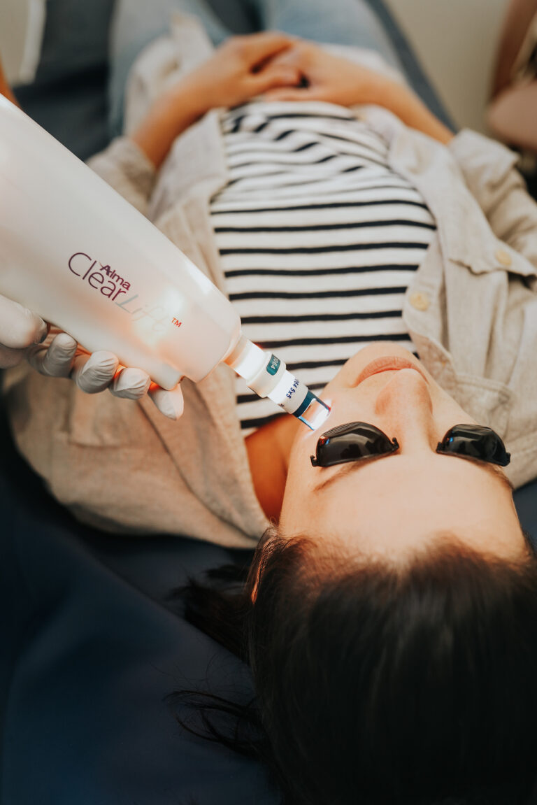 How to treat sun damage from living in Montana